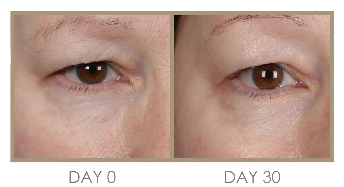 Genie | H'eye'drator Eye Cream